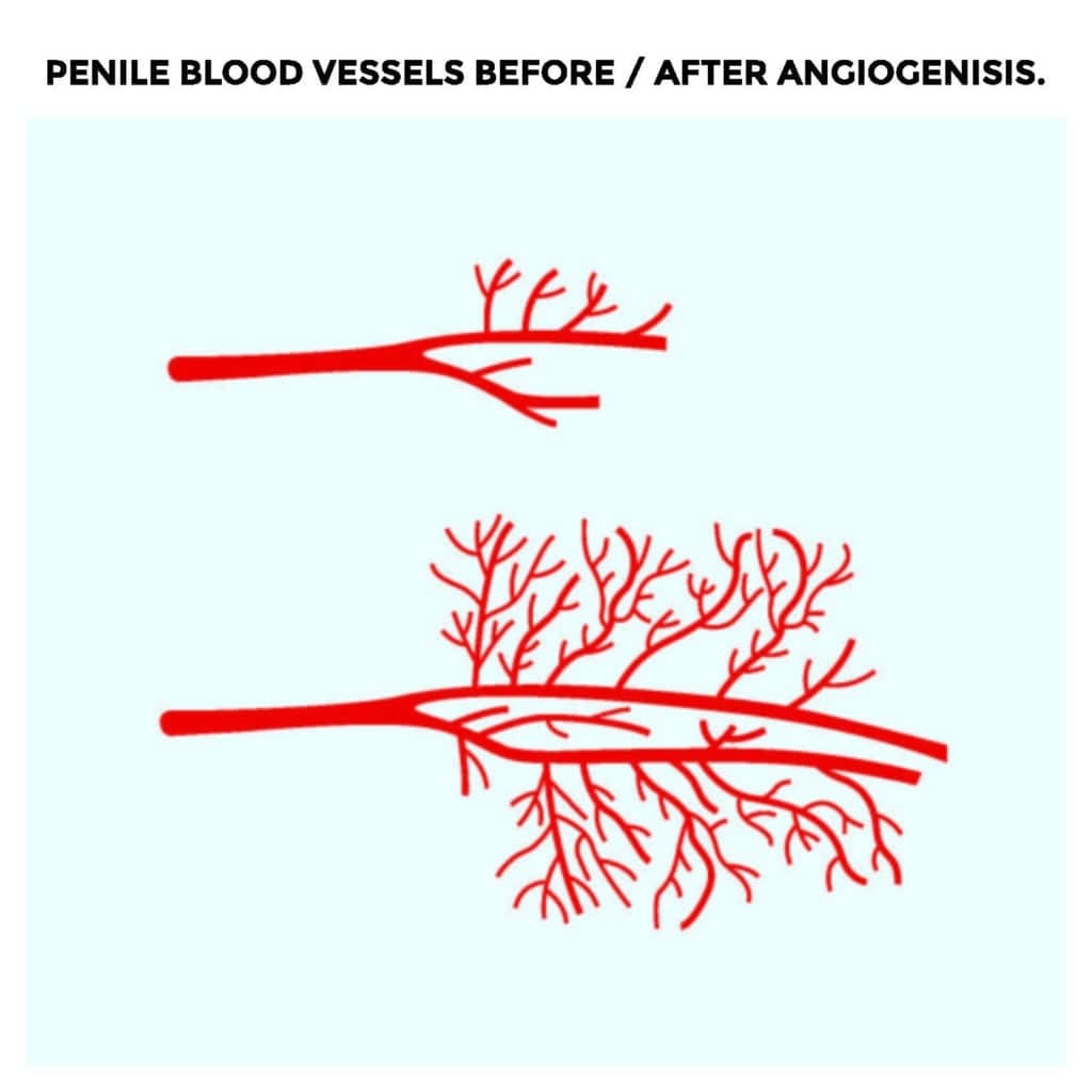 Big D Wave Austin TX Erectile Dysfunction Treatment