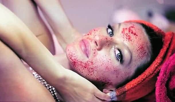 Vampire Facial Austin TX Vampire Facial Austin TX