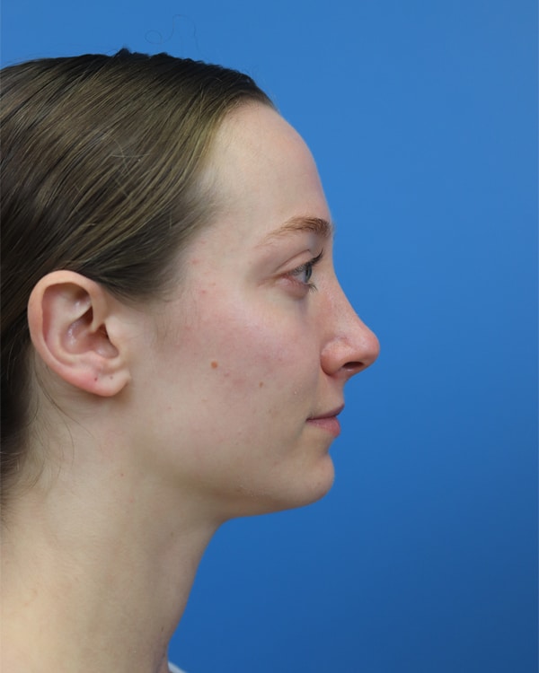 After Image