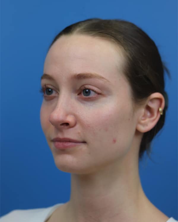After Image