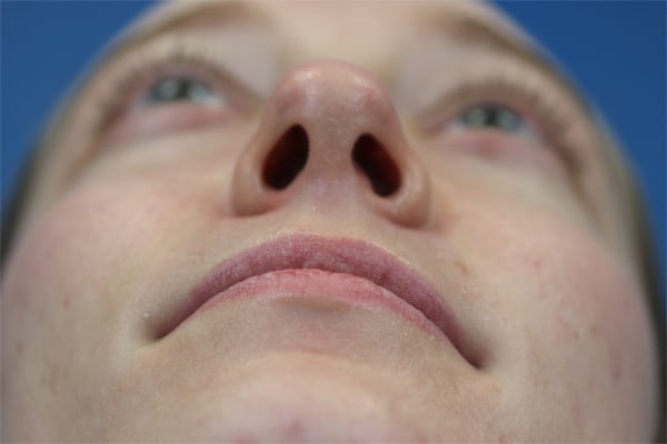 After Image