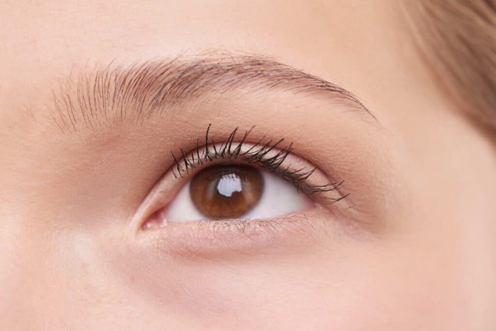 Brow Lift