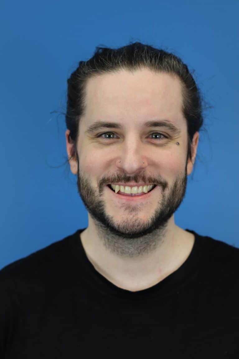 Before Image: Open Septorhinoplasty - front